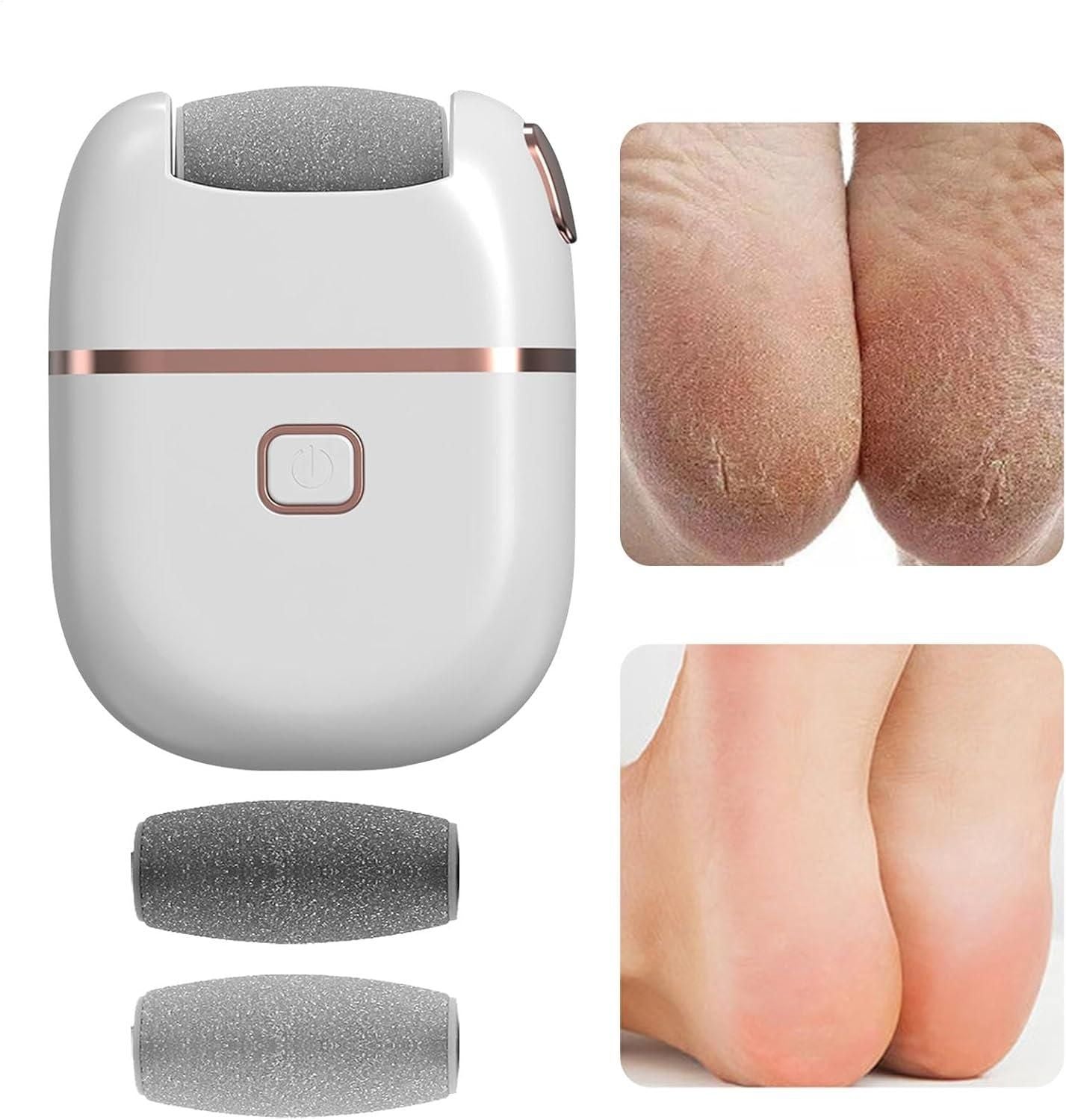 Electronic Pedicure Callus Remover – Rechargeable Foot Care Tool for Smooth, Soft Heels (Portable & Gentle)